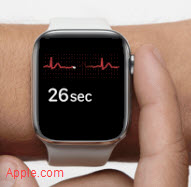 Apple Watch ECG EKG